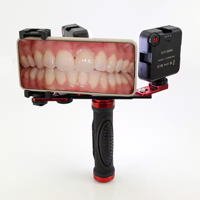 Photography Treatment - 歯科用モバイル写真撮影LEDライト 口腔内写真・ビデオ用フラッシュライト 照明器具 歯科医治療用ランプ